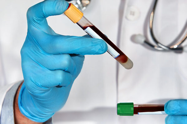 What Your Doctor ISN’T TELLING YOU About Your Bloodwork