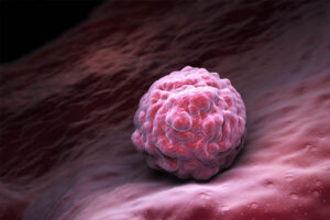 Reverse Aging and Chronic Disease with Stem Cell Therapy | Dr. Rafael Gonzalez